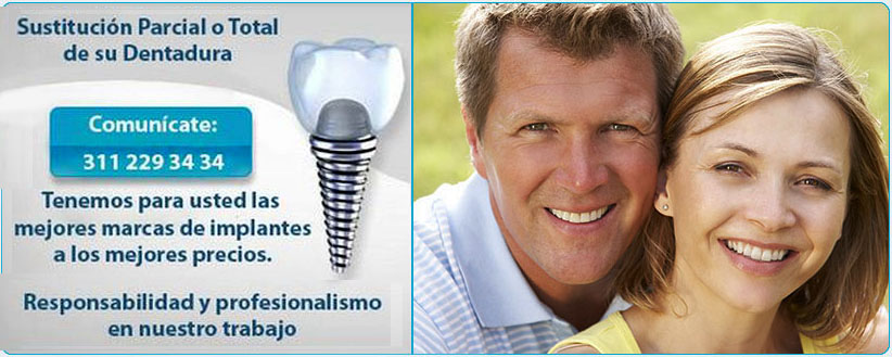 implantes dentales Cúcuta